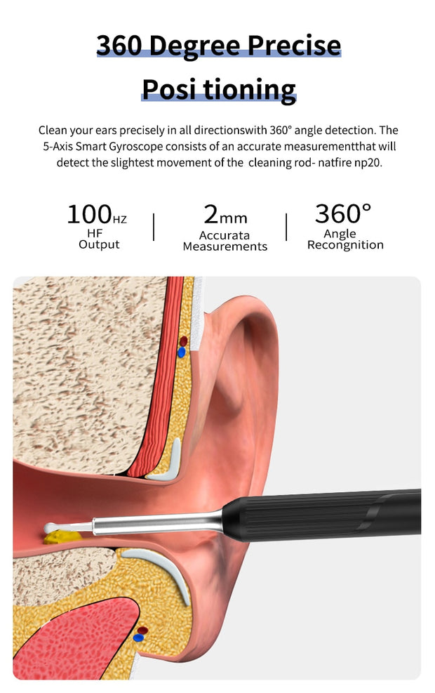 Smart Ear Cleaner - Kamera-Ohrendoskop